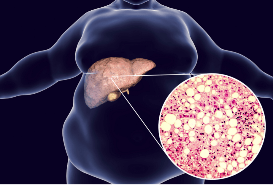 Obesity and Gastrointestinal Cancers