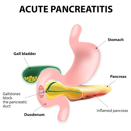 a diagram of a pancreas