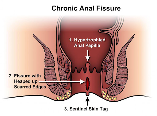 diagram of a human body with a pain in the throat