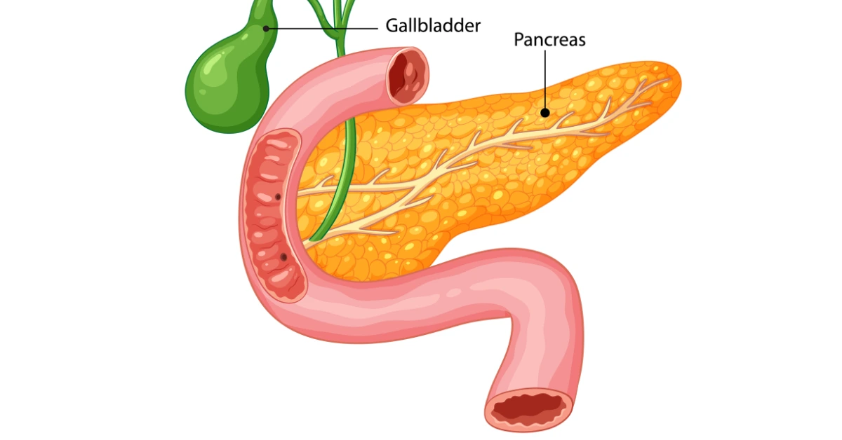 Chronic Pancreatitis Treatment