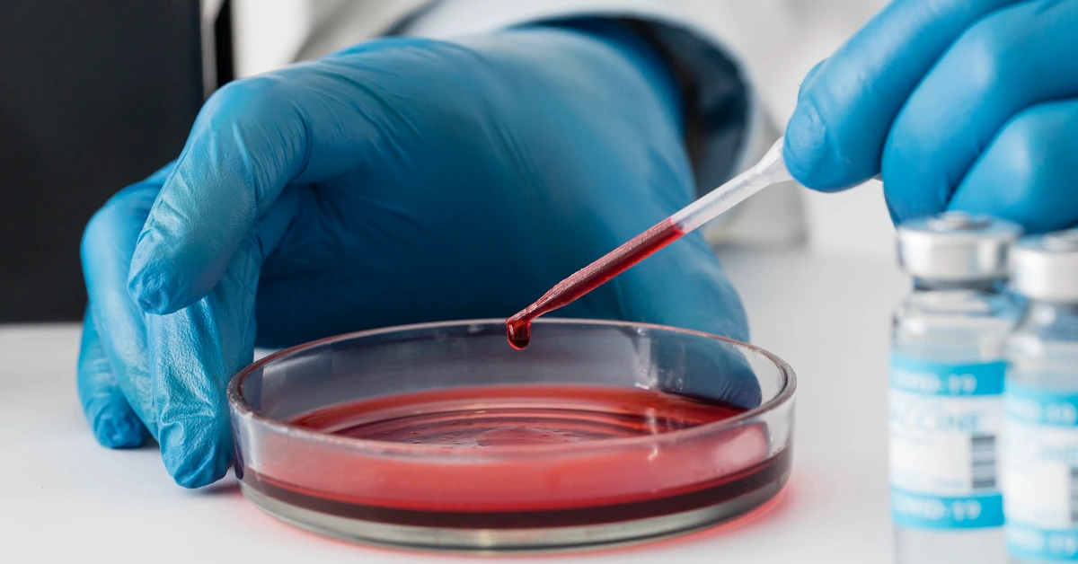 Blood in Stool Treatment