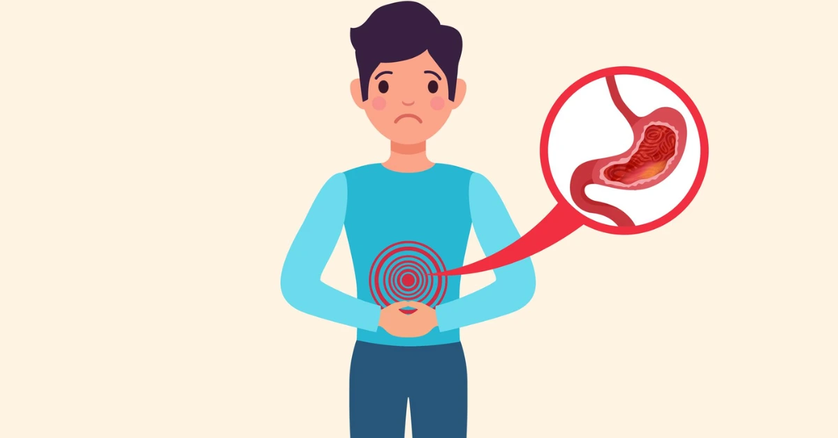 Hiatal Hernia Treatment